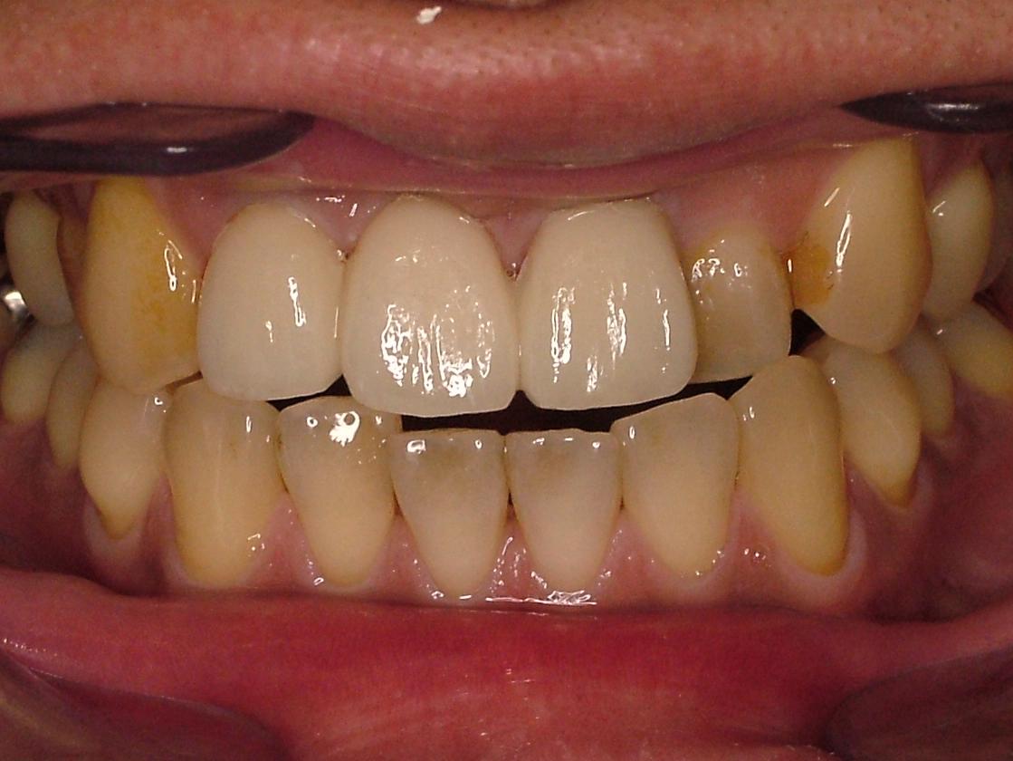 0000006932_IntraOral_20091124105726.jpg