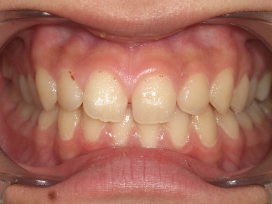 IntraOral_20110214201058.jpg