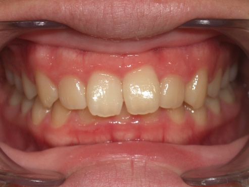 IntraOral_20110731155150.jpg