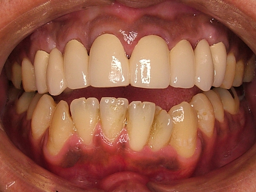 IntraOral_20120219201629.jpg