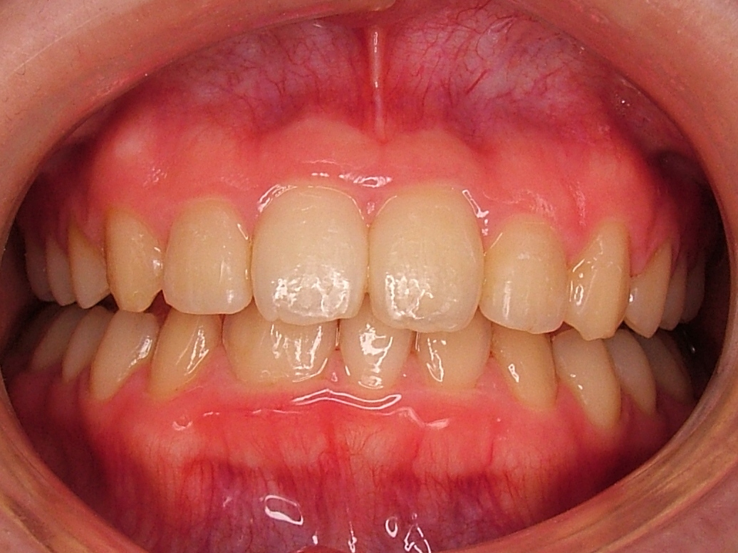 IntraOral_20120227123117.jpg