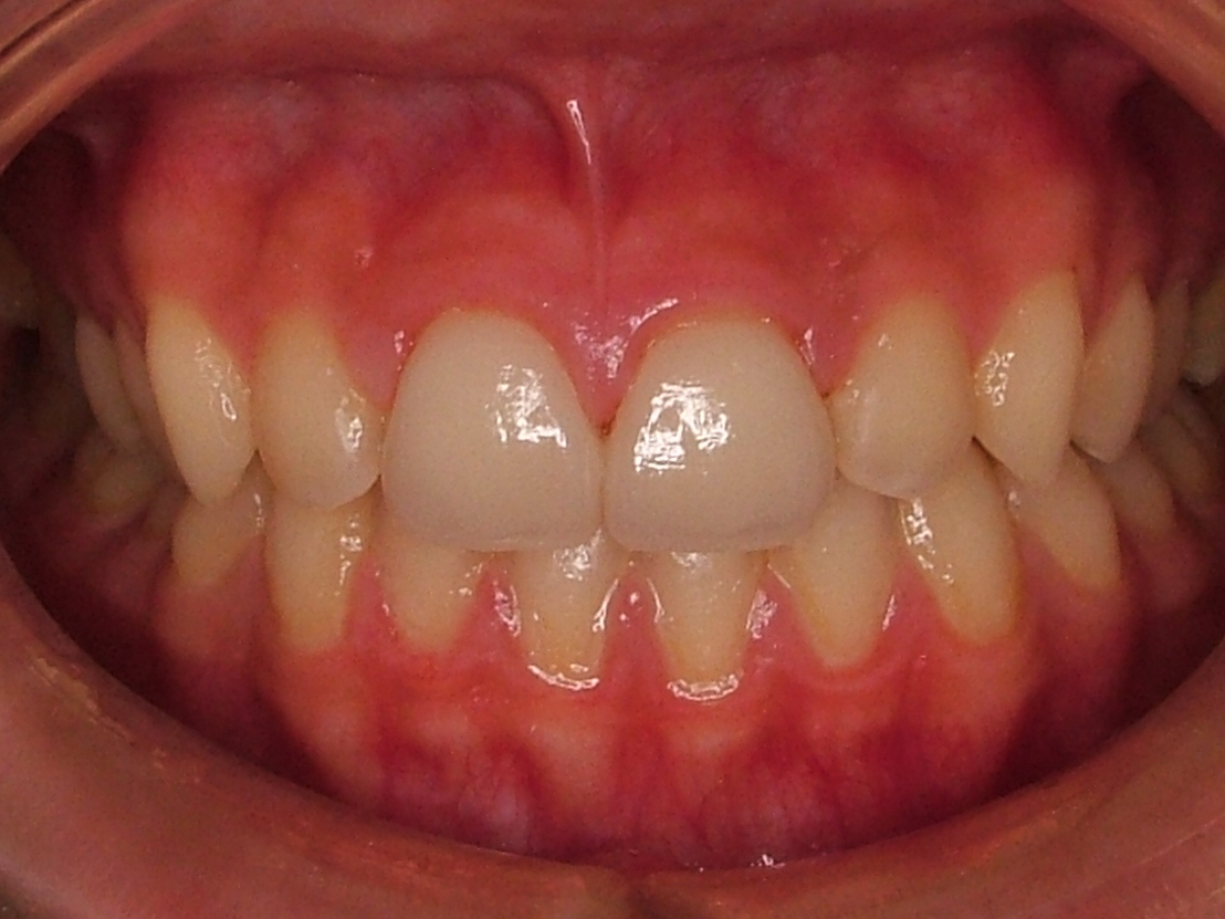 IntraOral_20120227184036.jpg